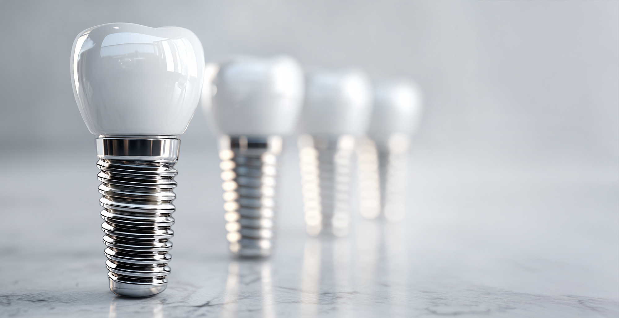 Implant zęba – nowoczesna implantologia i odbudowa zębów Wrocław